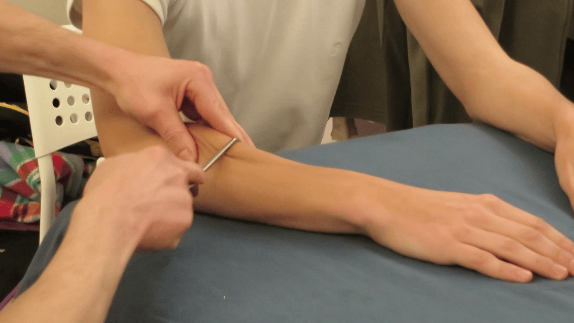 Terapia manuale con fibrolisori